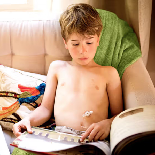 Children-Feeding-Tube-Care
